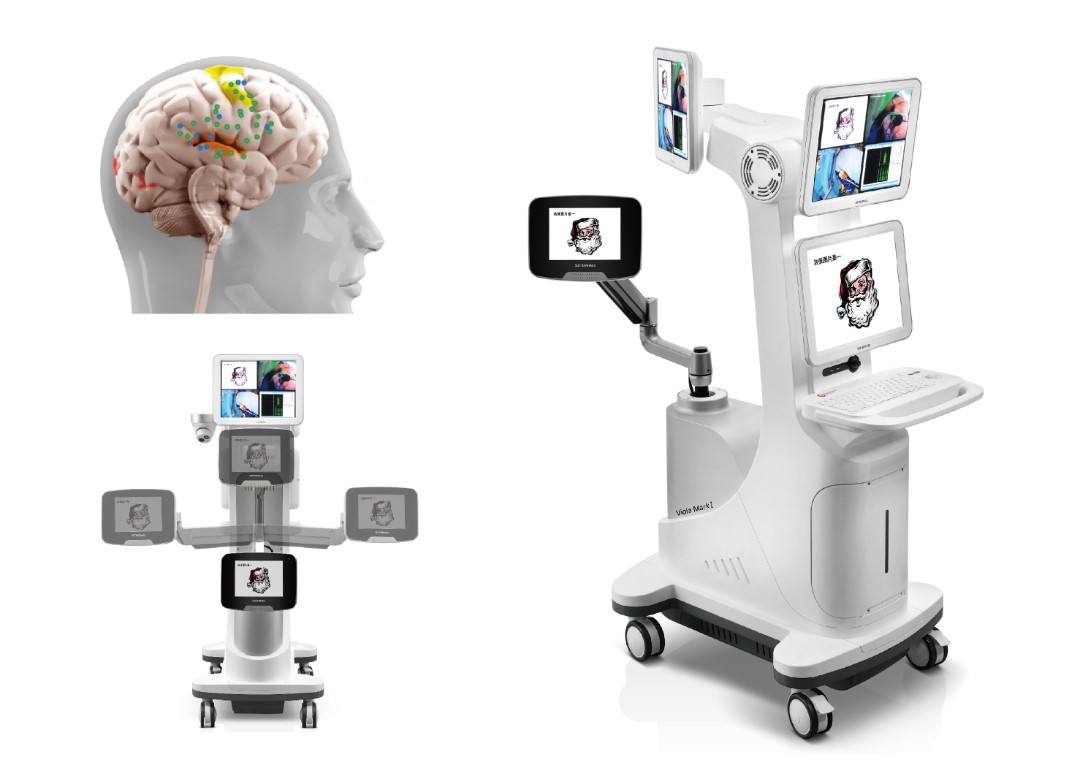 1673229622103142.jpg 腦功能術(shù)中刺激系統(tǒng).jpg